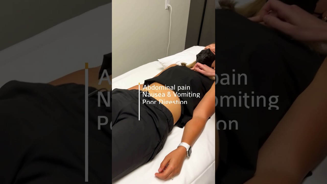 Can Acupuncture Treat Digestive Conditions?