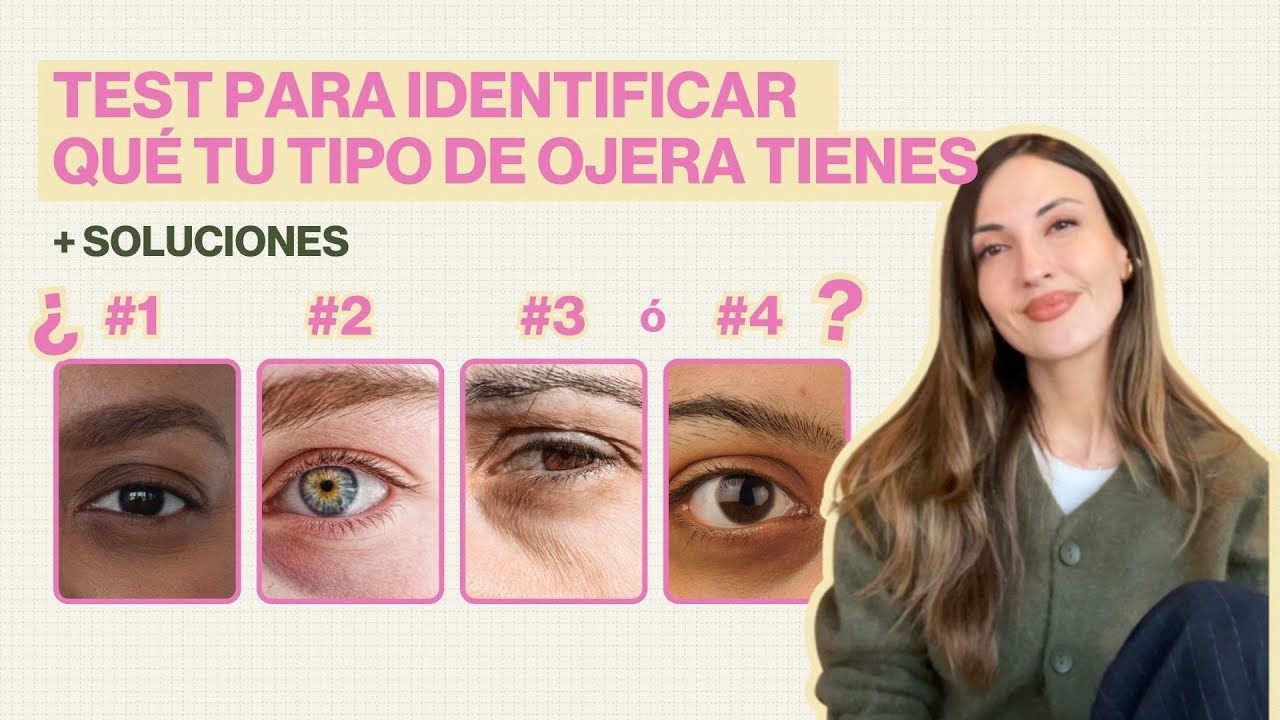 Los 4 Tipos de Ojeras + SOLUCIONES