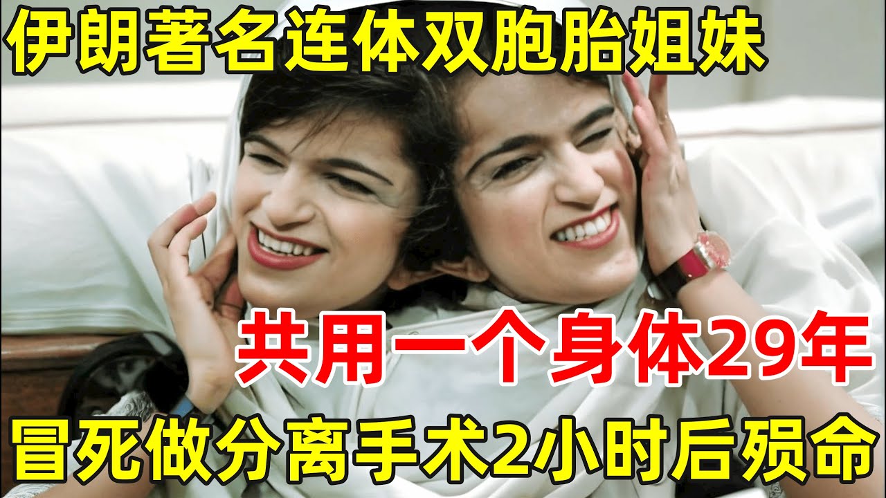 伊朗著名连体双胞胎姐妹,共同生活29年,冒死做分离手术,分开2小时后殒命【历史纪实&middot;精编版】