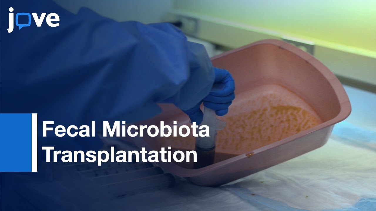 Fecal Microbiota Transplantation via Colonoscopy | Protocol Preiew
