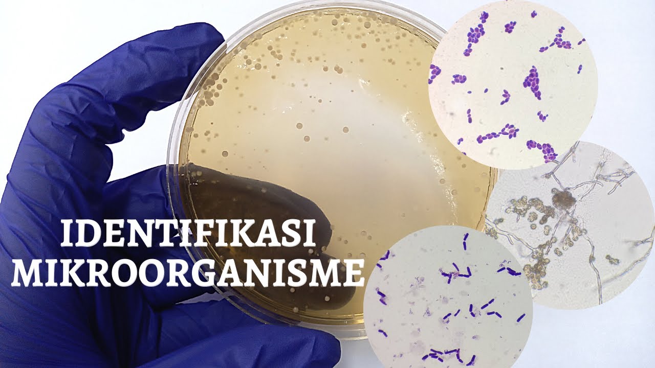Identifikasi Mikroorganisme/Screening Bakteri/Streak kuadran/Bacteria Indentification/Single colony