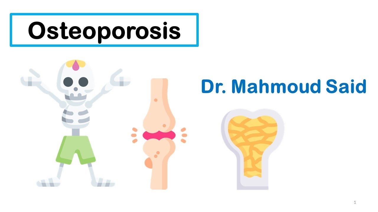 Bone Disorders-4- Osteoporosis therapeutics هشاشه العظام
