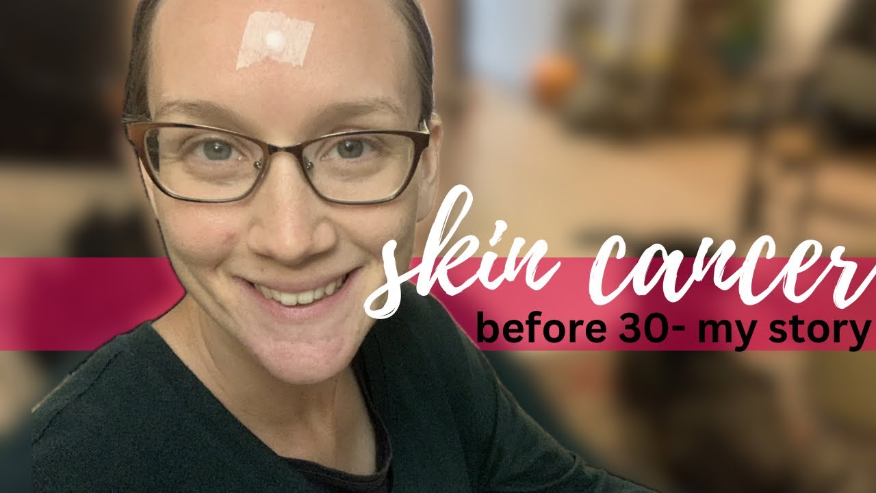 I have skin cancer. + other personal news