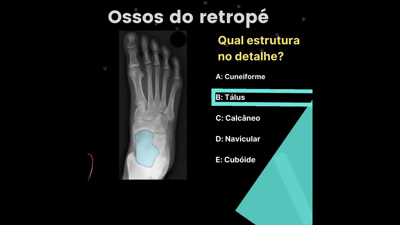 Ossos do retrop&eacute;