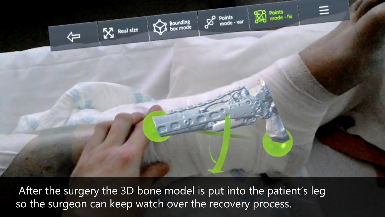 Practical use VOKA.IO (17.07.PI) - computer vision system for trauma surgeries