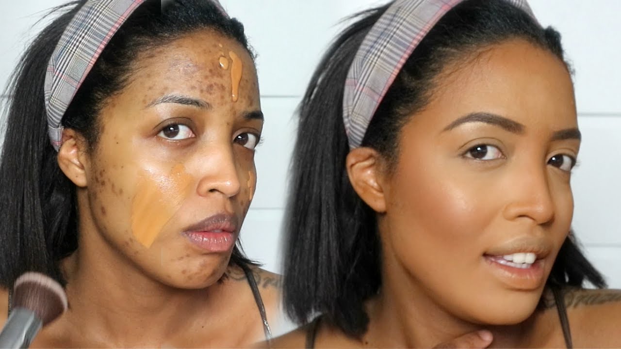 HOW TO HIDE ACNE SPOTS ON BLACK SKIN WITH MAKEUP