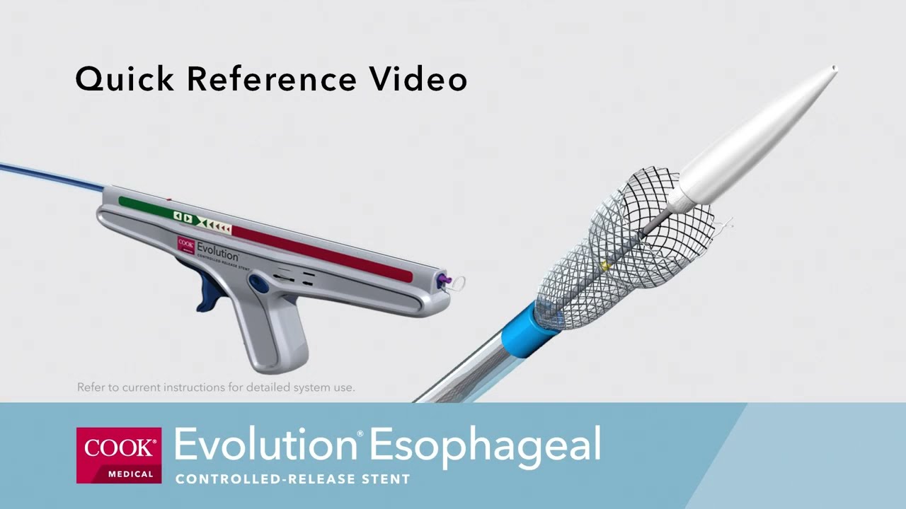 Evolution® Esophageal Controlled-Release Stent Quick Reference Video