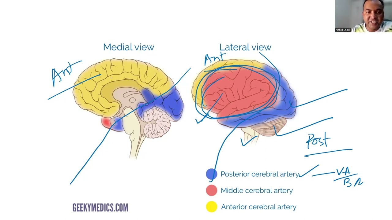 stroke (neurology , davidson 24th edition)