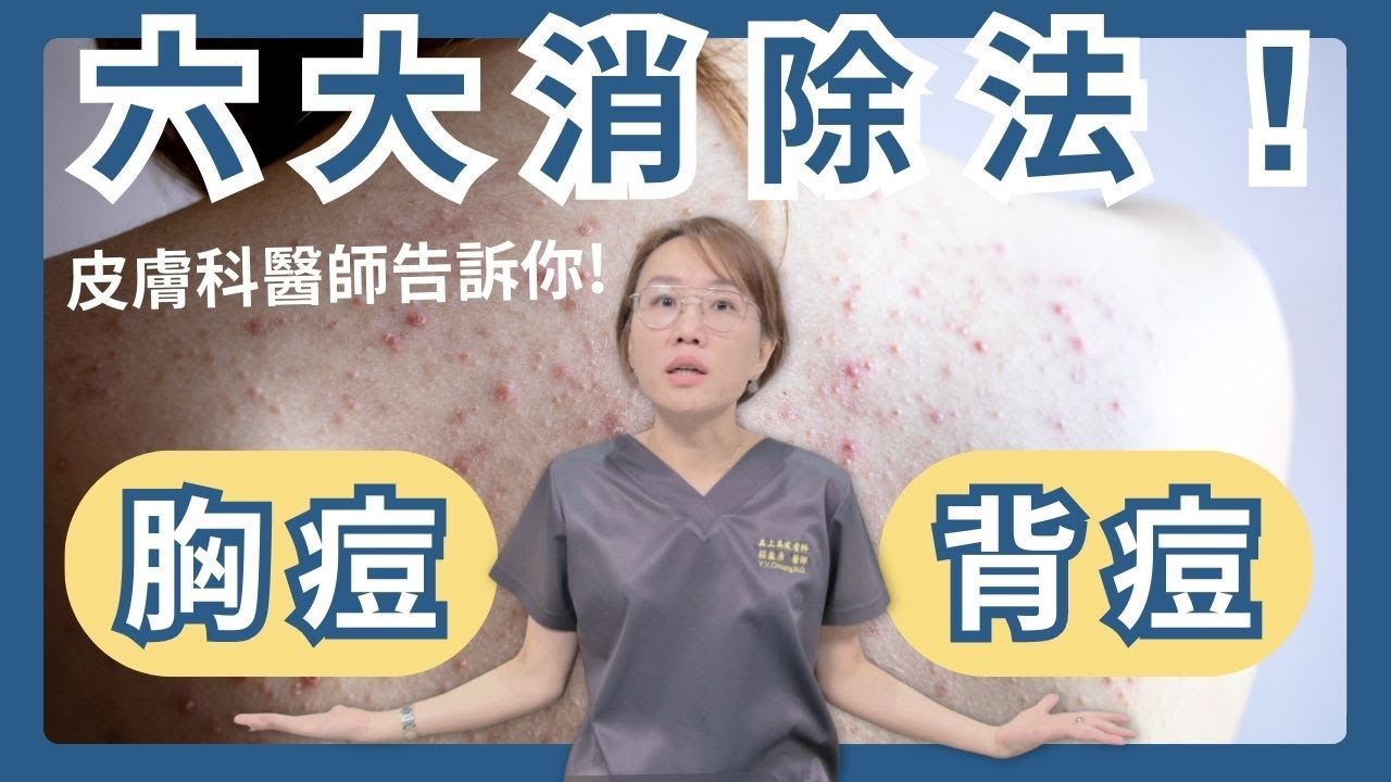 前胸、背後長青春痘，令人又痛又惱！皮膚科醫師告訴你，消除背後的六大招！