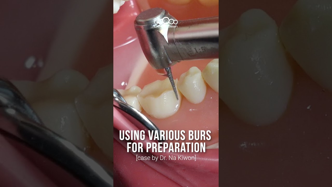 Using Various Burs for Preparation #dentalbean
