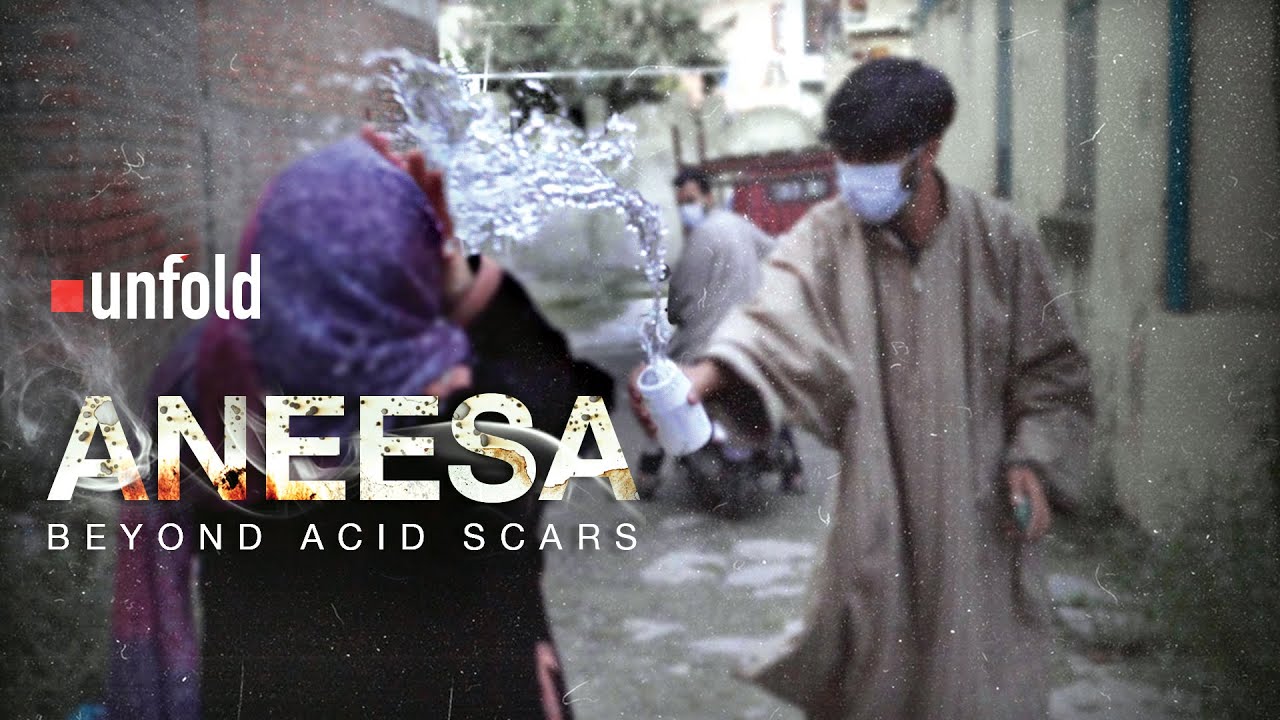 Aneesa's Fight: From Pain to Power | An Acid Survivor's Journey