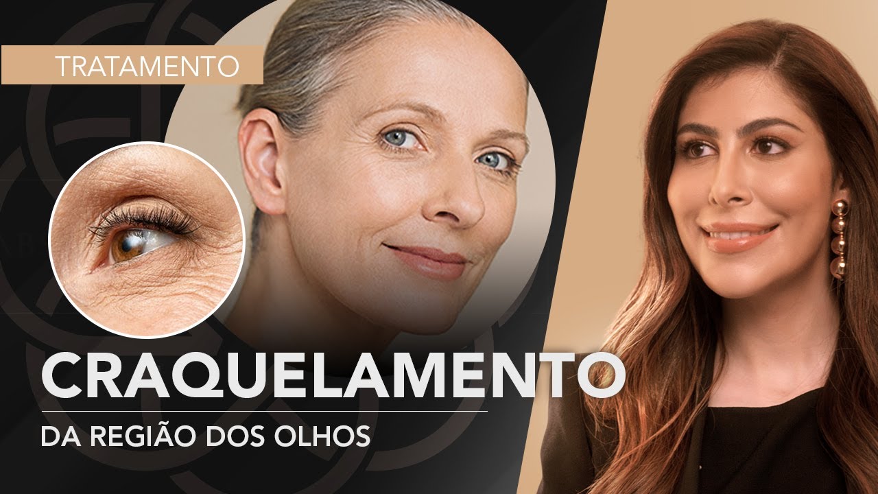 Linhas Abaixo dos Olhos: Tratamentos para Maquiagem Que Craquela | Dra. Daniela Aidar