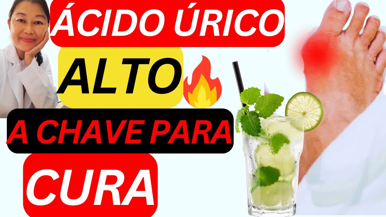 Ácido Urico Alto o que fazer para melhorar