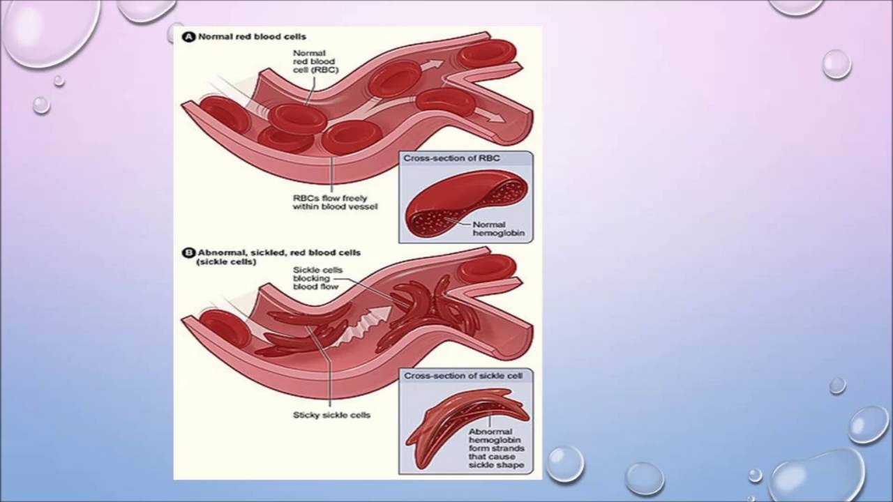 What is Plasmapheresis? Susan Main, Nurse Clinician