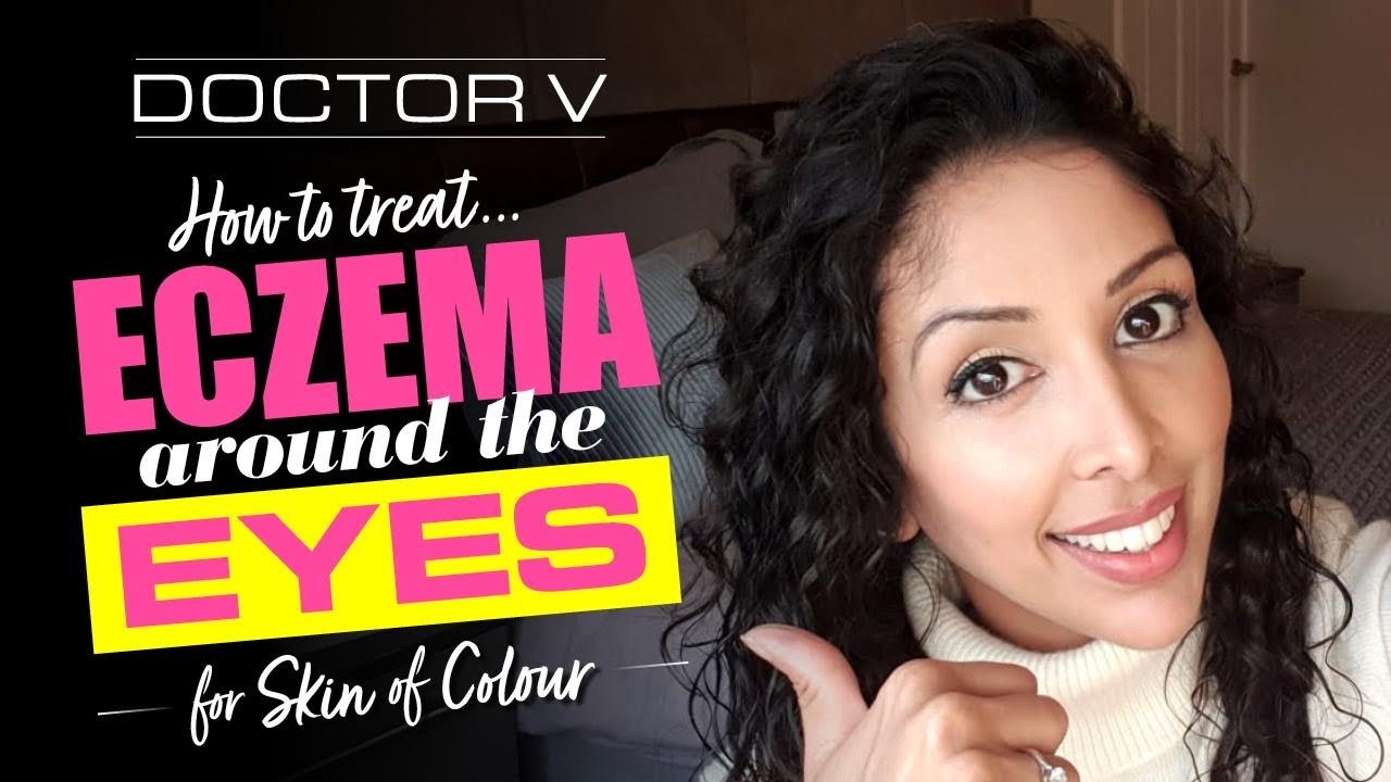 Doctor V - How To Treat Eczema around the Eyes for Skin of Colour | Black or Brown Skin