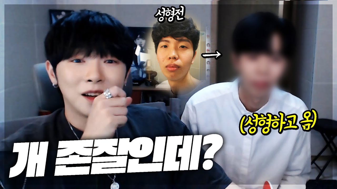 매니저가 저보다 더 잘생겨져서 돌아왔습니다;; 【쌍커풀 수술 후기】