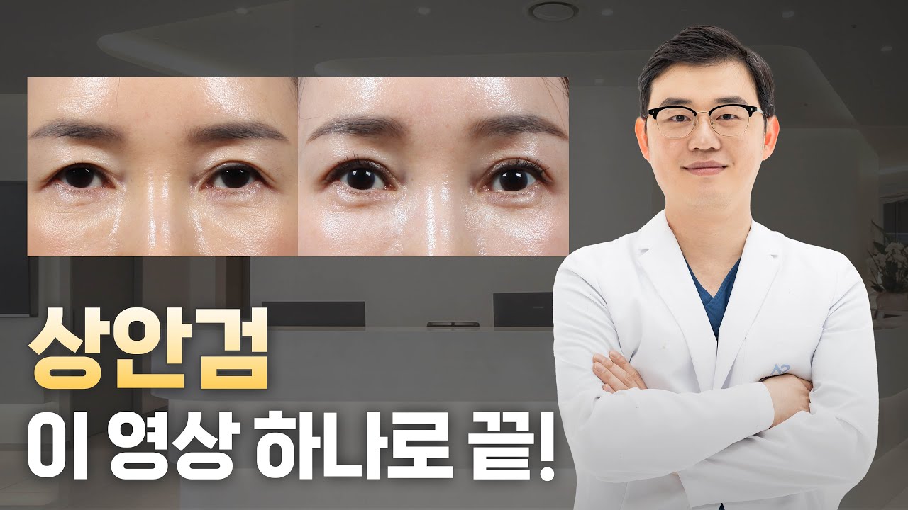 🎥 상안검 수술, 이 영상 하나면 끝!! 제대로 알고 수술 결정하세요!!