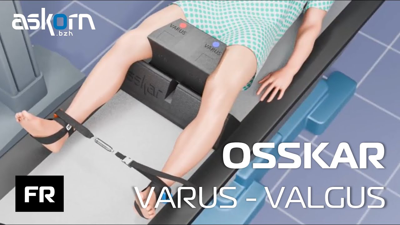 [FR] OSSKAR Varus Valgus | Dispositif de positionnement pour radiographies du genou sous contrainte
