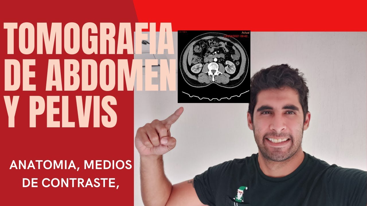 Tomografía abdomen y pelvis con contraste. Anatomía Abdominal,  fases, indicaciones, contraste oral