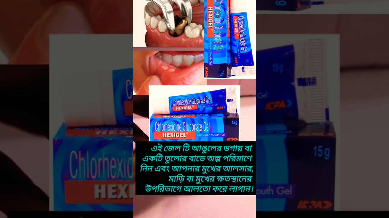 Hexigel antiseptic mouth gel || মুখে ঘা ও ক্ষত  #antiseptic #mouth #gel #disease #youtubeshorts #