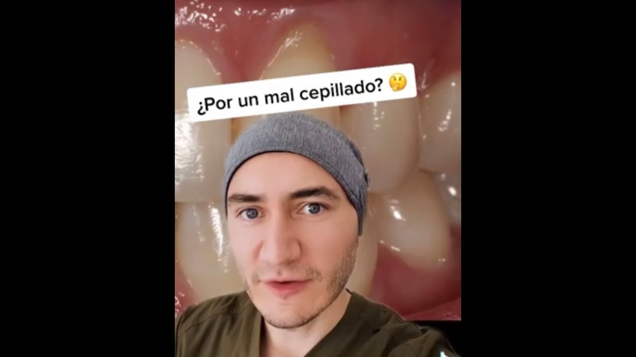 Se cepilla bien y a&uacute;n as&iacute; su enc&iacute;a se retrae &iquest;Qu&eacute; sucede?🤔 #shorts
