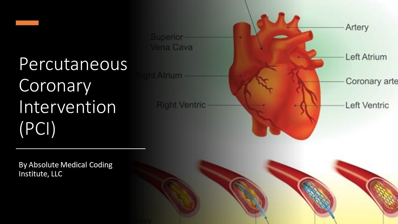 CPT Medicine Section:  Percutaneous Coronary Intervention (PCI) Coding