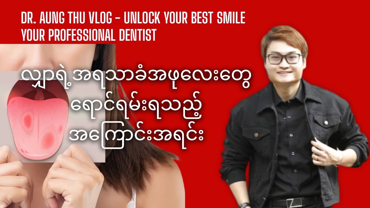 လျှာရဲ့အရသာခံအဖုလေးတွေ ရောင်ရမ်းရသည့် အကြောင်းအရင်း