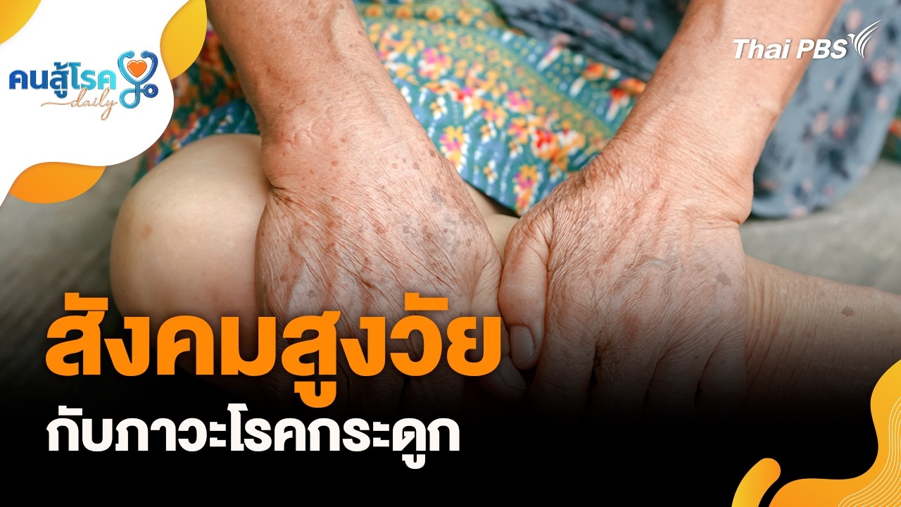 สังคมสูงวัย กับภาวะโรคกระดูก | คนสู้โรค Daily | 23 ก.พ. 69