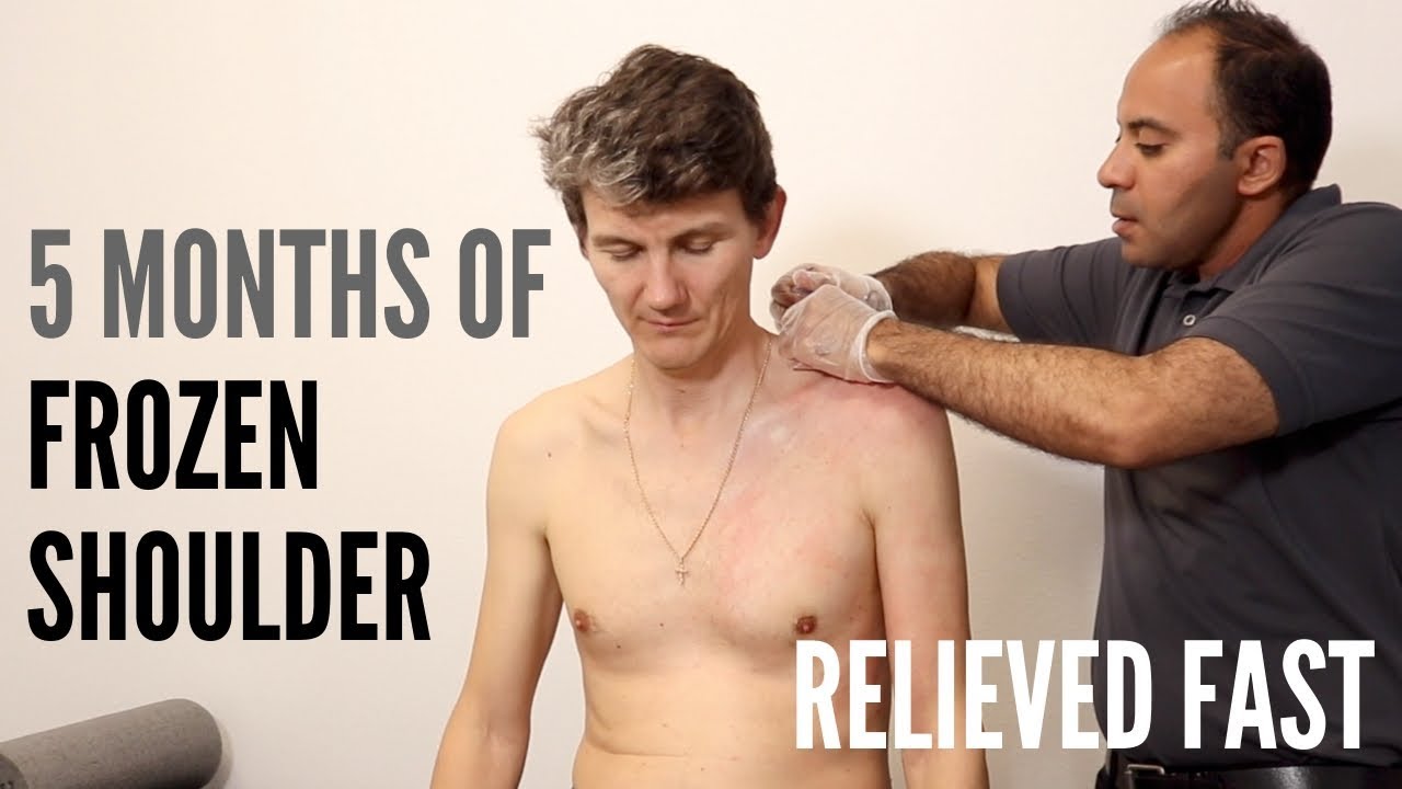 5 Months of Frozen Shoulder Relieved FAST  (+ FOLLOW-UP !!!!)