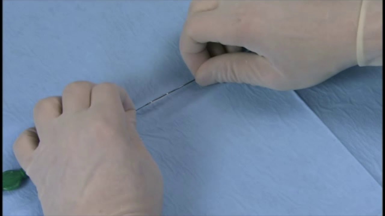 Angioplasty technique: retrieving of a balloon (English subtitle)