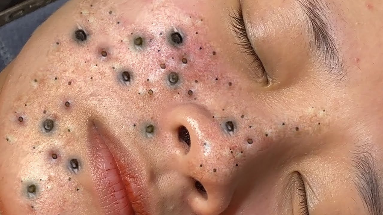 𝑺𝒐𝒐𝒕𝒉𝒊𝒏𝒈 𝑭𝒂𝒄𝒊𝒂𝒍 𝑻𝒓𝒆𝒂𝒕𝒎𝒆𝒏𝒕 𝑭𝒐𝒓 𝑺𝒕𝒓𝒆𝒔𝒔 𝑹𝒆𝒍𝒊𝒆𝒇 𝒂𝒕 𝑳𝒖𝒙𝒖𝒓𝒚 𝑺𝒑𝒂 𝑨𝒄𝒉𝒊𝒆𝒗𝒆 𝑰𝒏𝒏𝒆𝒓 𝑷𝒆𝒂𝒄𝒆 #500433