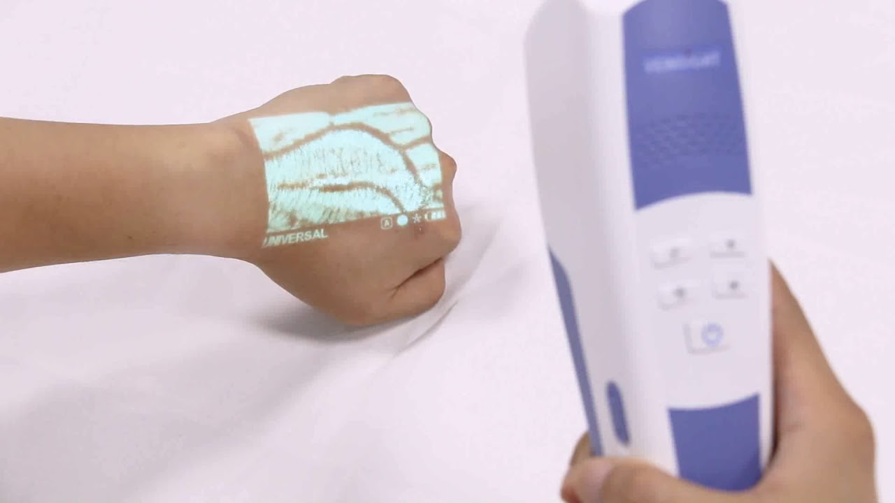 Vein Finder-VS500-Guide to the VeinSight VS500