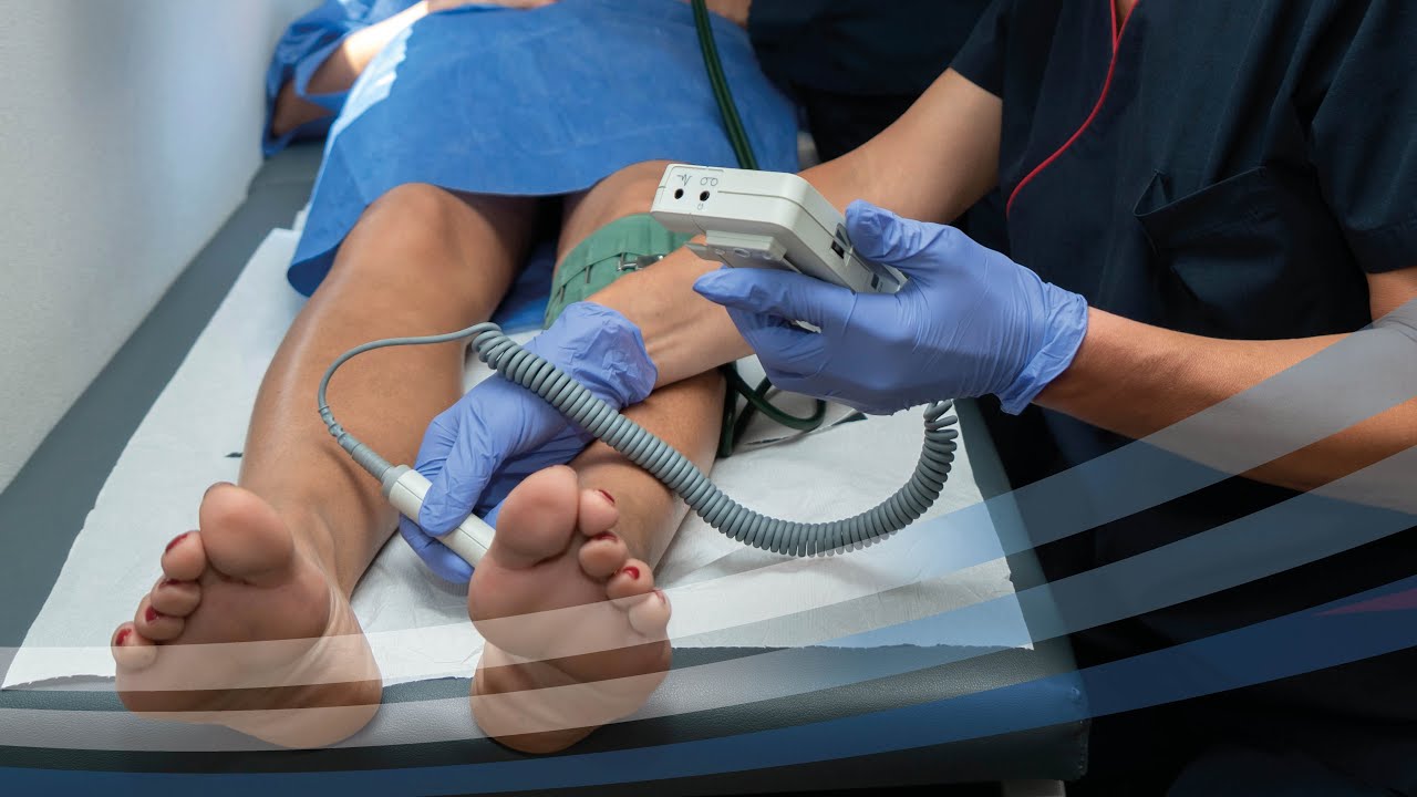 Se si ammalano le arterie delle gambe