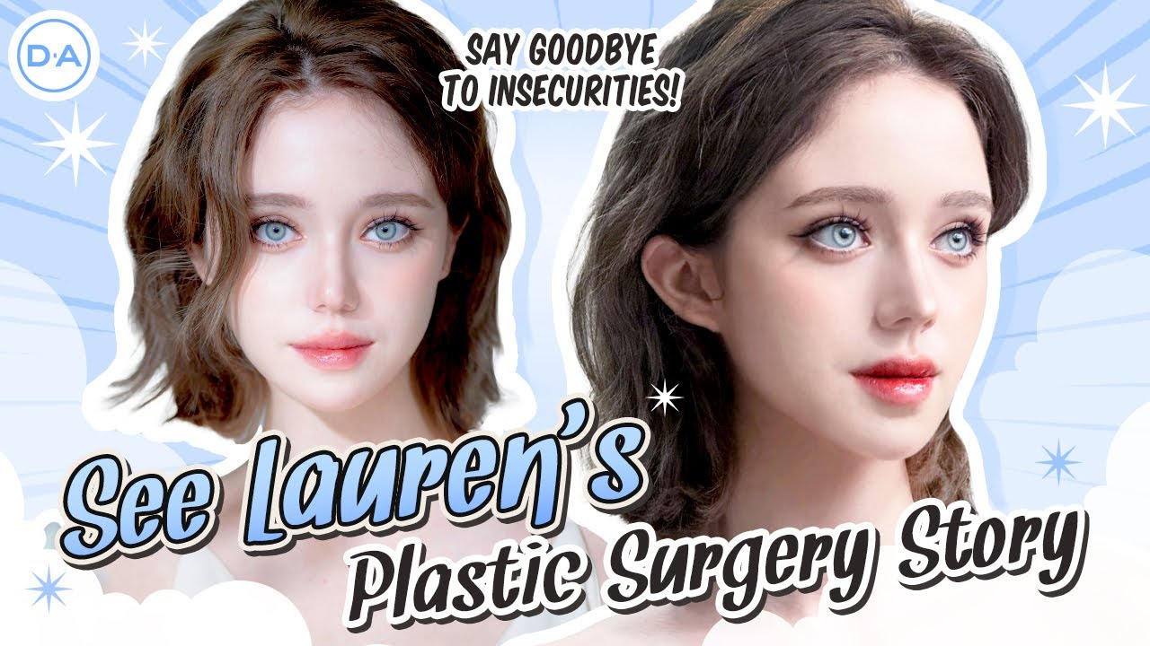 [Plastic Surgery Korea] Say goodbye to insecurities!  V-Line surgery