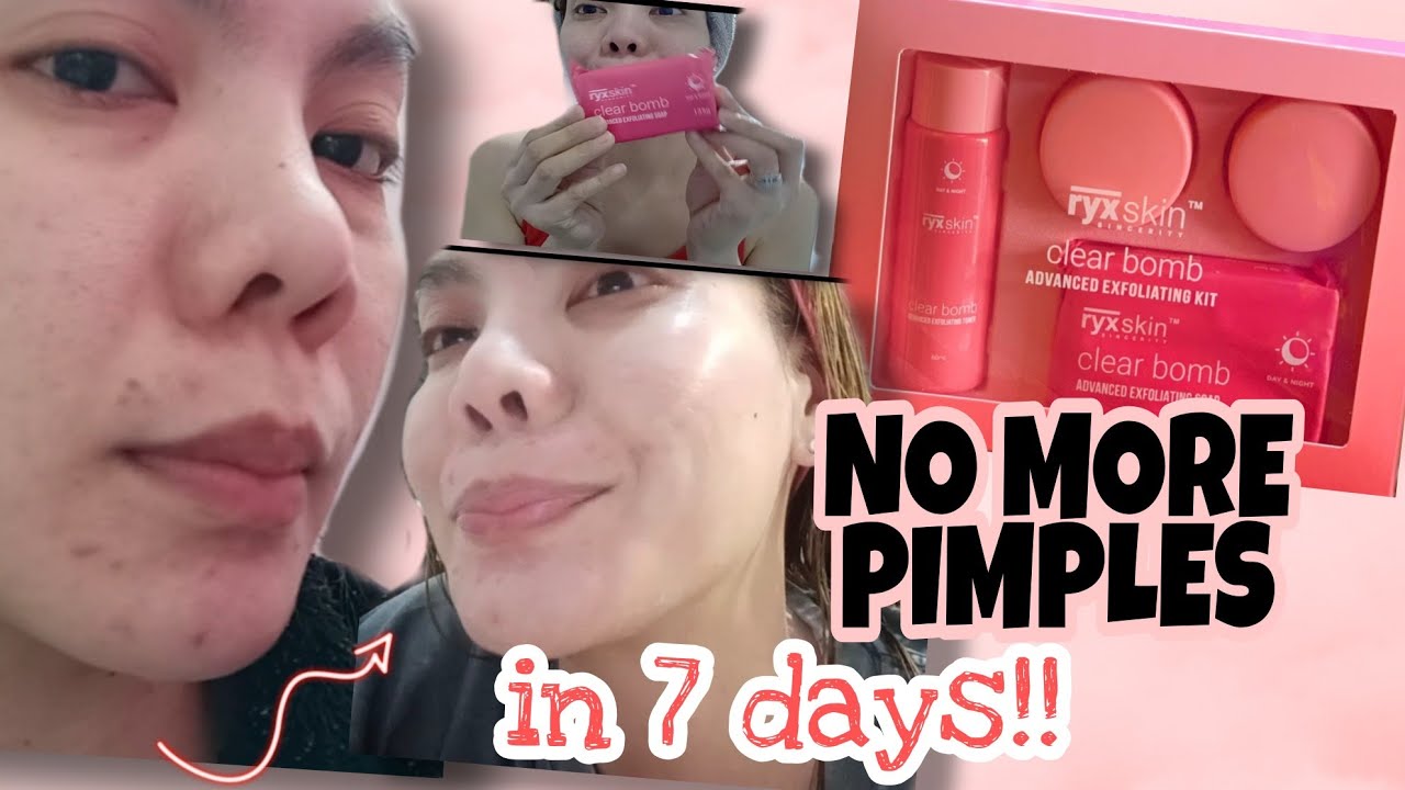 RYX SKINCERITY CLEARBOMB HONEST REVIEW