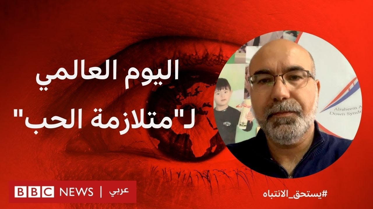 كيف يمكن التعامل مع طفل متلازمة داون؟