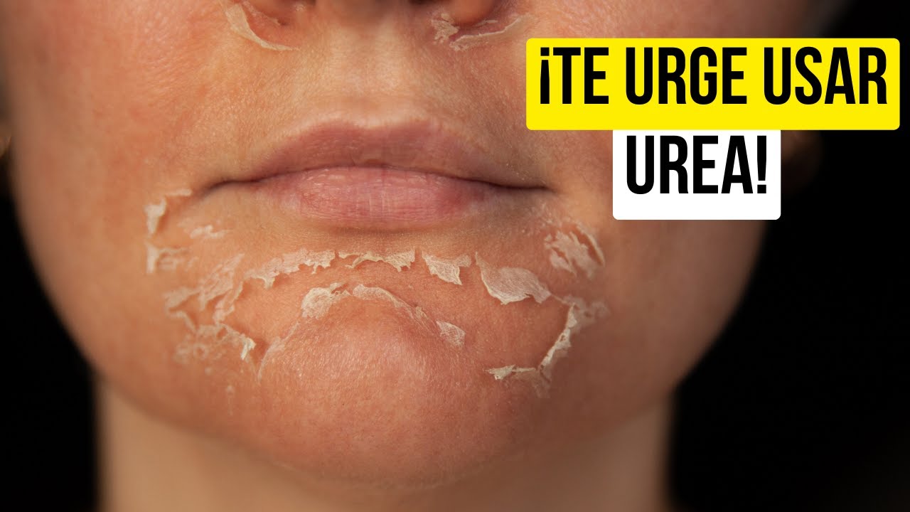 Descubre los Increíbles Beneficios de la Urea para una Piel Saludable
