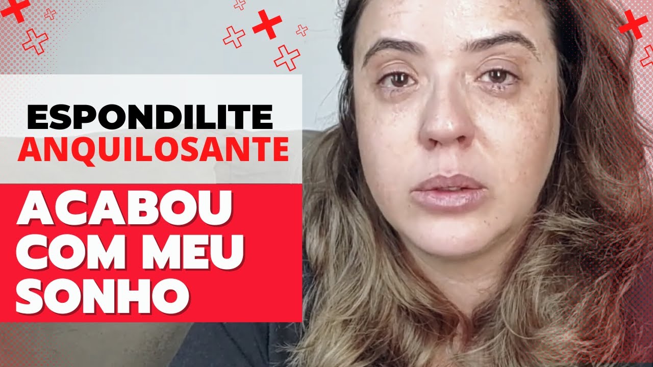 ESPONDILITE ANQUILOSANTE - ESSA DOENÇA ACABOU COM MEU SONHO