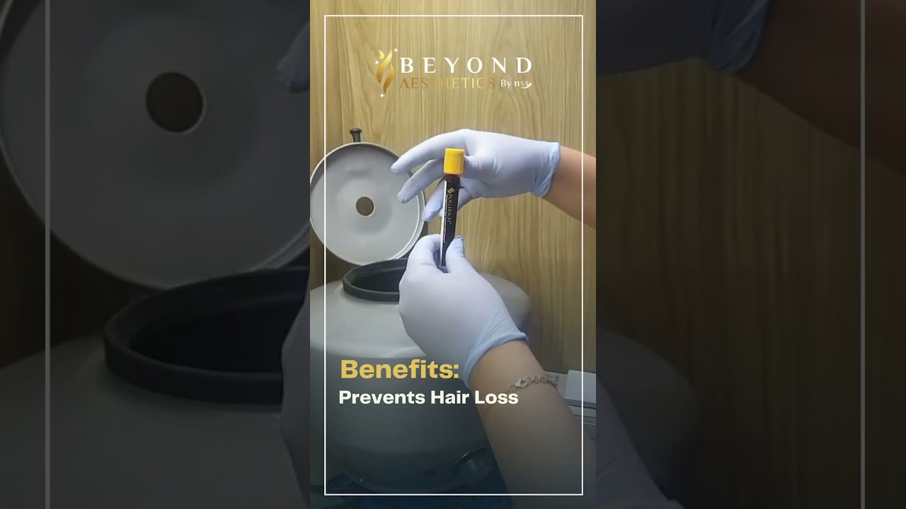 GFC Treatment ( Growth Factor Concentrate) Hair growth treatment #shorts #beyondaesthetics