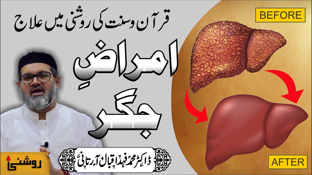 Jigar Ki Bimari Ka Ilaj - Jigar Ki Bimari Ka Rohani Ilaj - Dr. Fahad Artani Roshniwala Roshni Centre