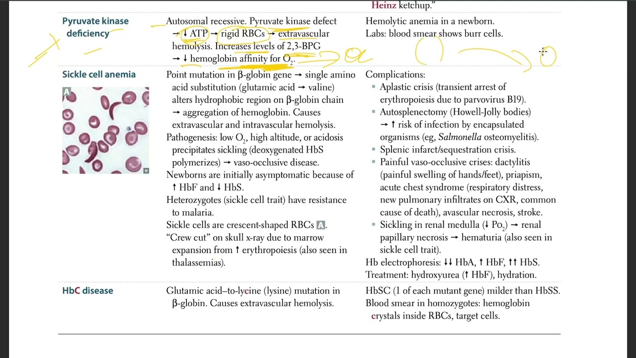 USMLE - 23  Pyruvate kinase deficiency | USMLE STEP 1 | (USMLE Step 1)