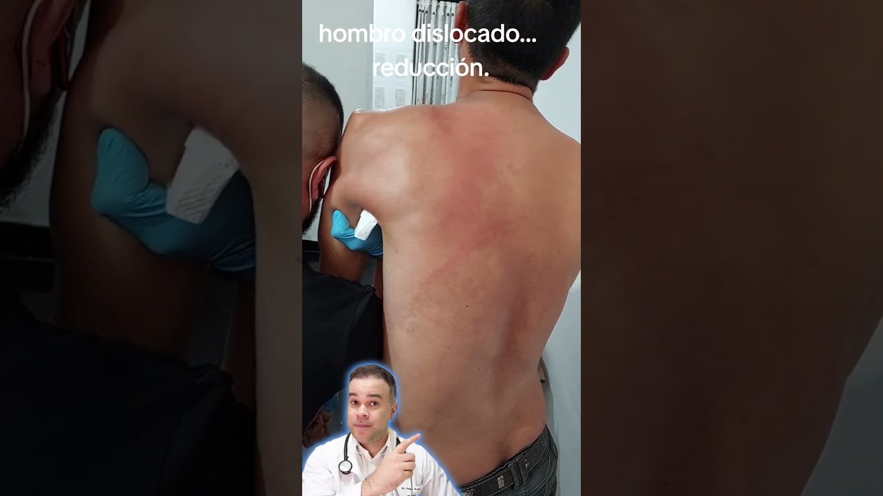 OMBRO voltando no LUGAR