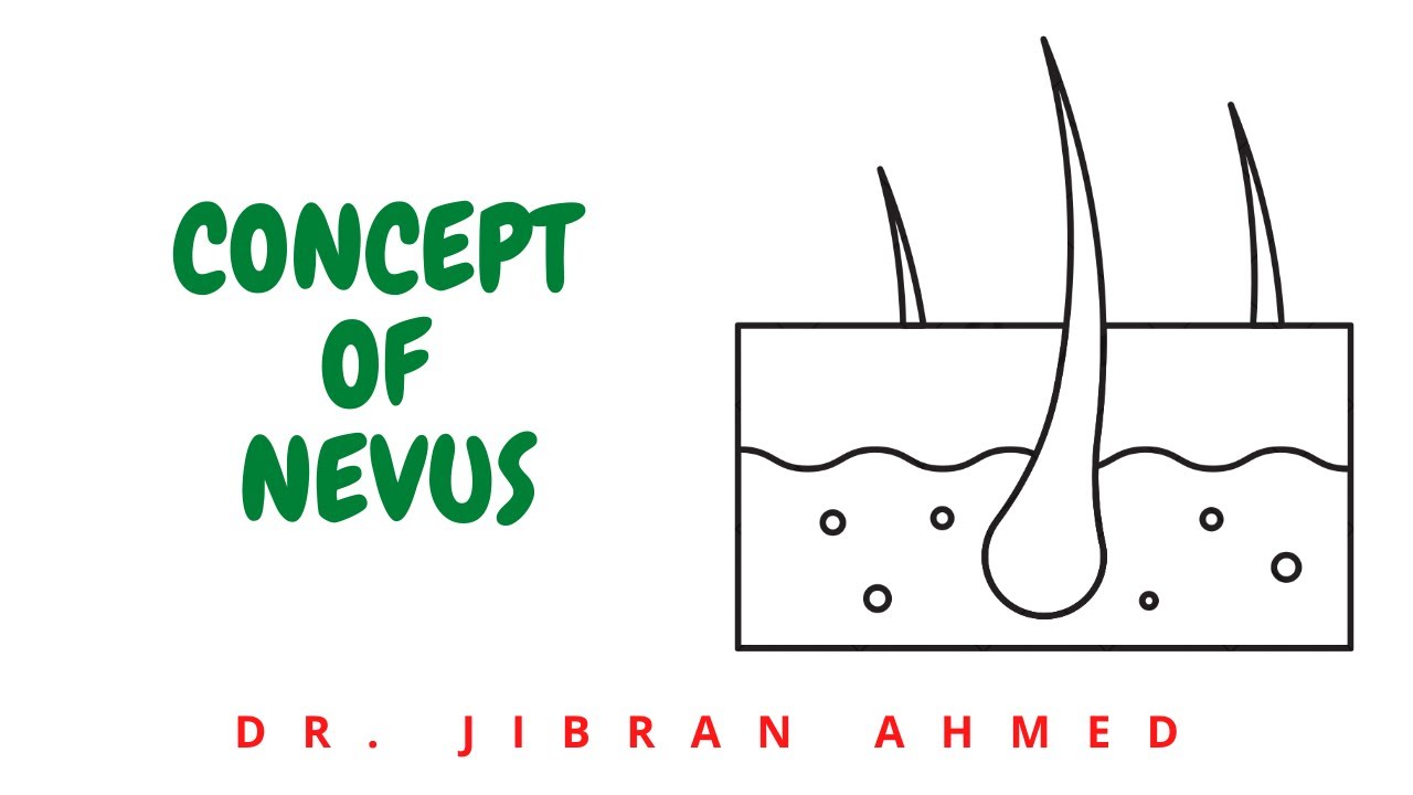 CONCEPT OF NEVUS II ROBBINS 10TH E II SKIN II PATHOLOGY LECTURES II SYSTEMIC PATHOLOGY