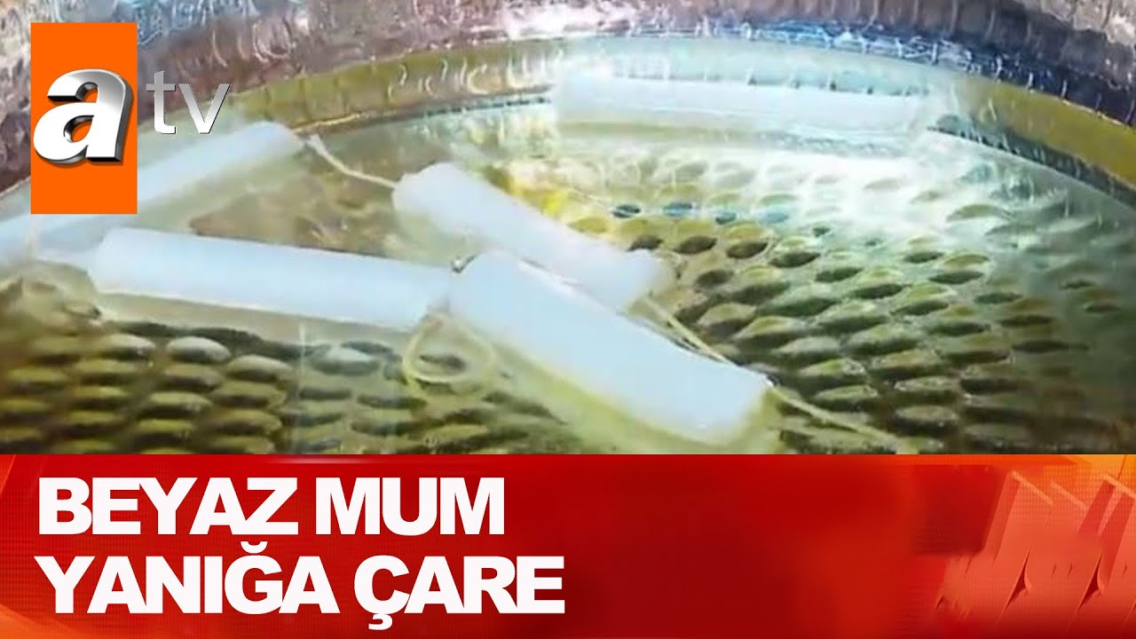 Beyaz mum yanığa çare - Atv Haber 5 Ağustos 2021