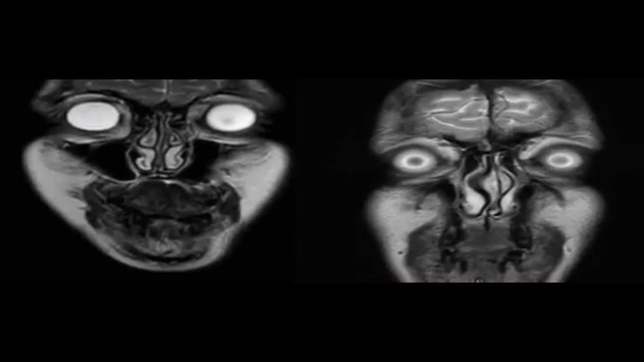 MRI Horror Story - Newcastle Clinic