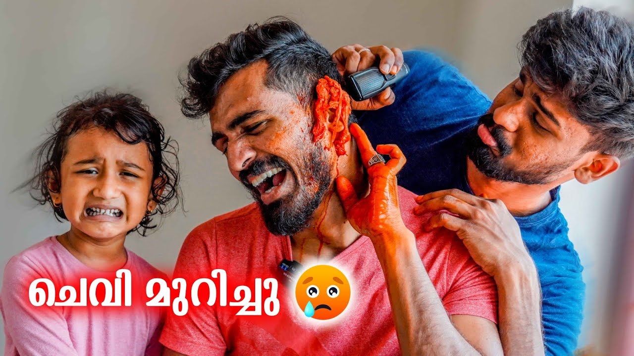 അവർ എന്റെ ചെവി മുറിച്ചു 😭They cut my ears off 😱
