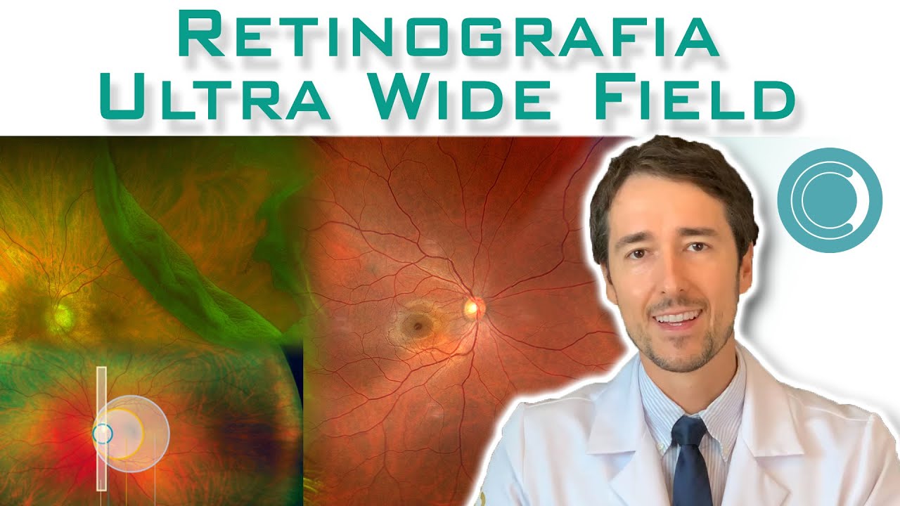 Exame de retina de campo amplo - Retinografia Ultra Wide Field