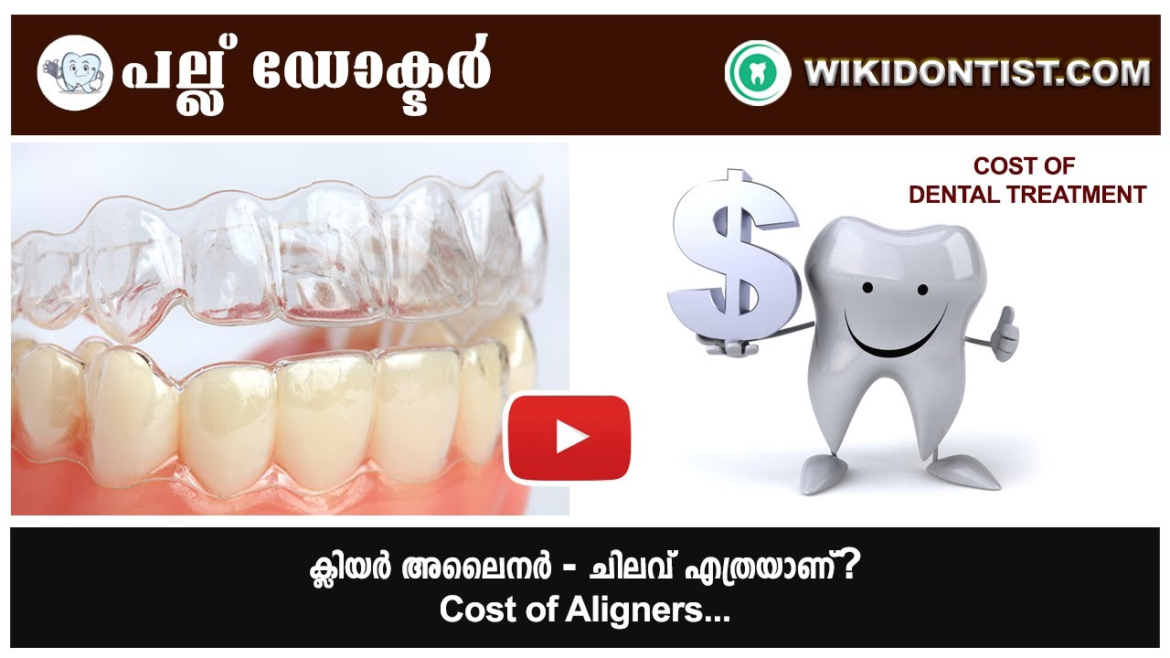 Сколько стоит Clear Aligner? Стоимость Clear Aligner / Видео от доктора Томаса Нечупадама
