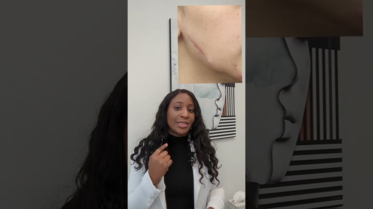 Scar Revision | That Face Facial Plastic Surgery