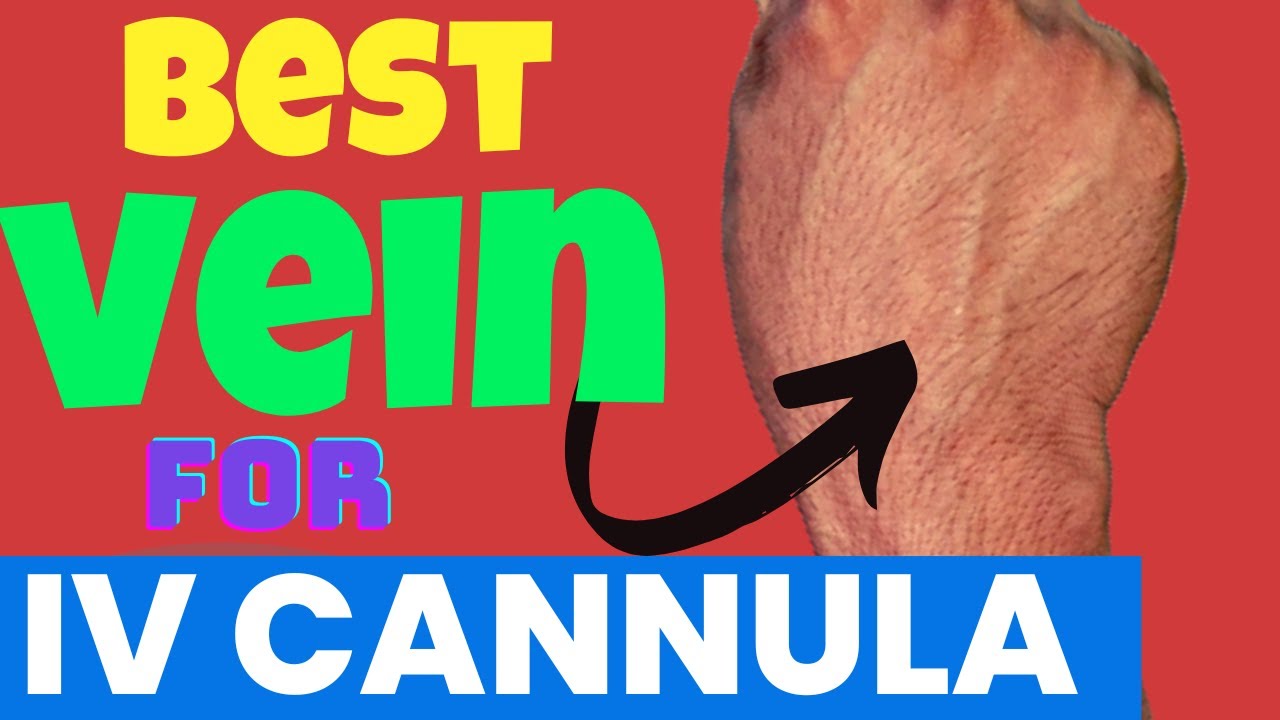 How To Find the Best Vein To Fix A Intravenous Cannula  in First Prick | iv Cannulation mede easy